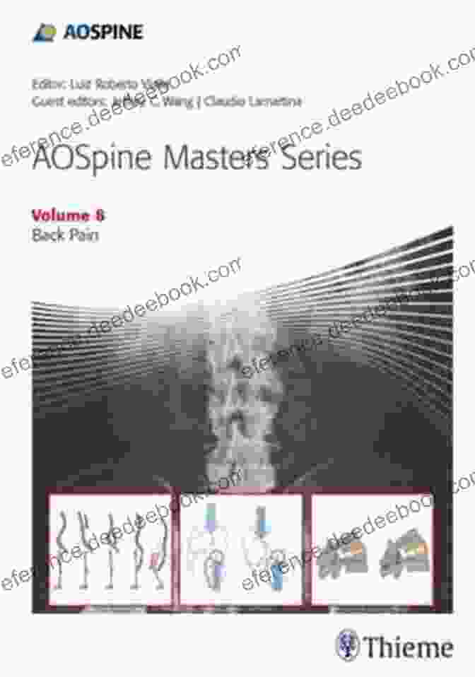 Aospine Masters Volume Back Pain AOSpine Masters Volume 8: Back Pain